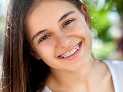 Best Orthodontic treatments(Braces) In Ahmedabad